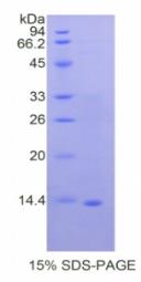 SDS-PAGE (LTF-7667H).jpg